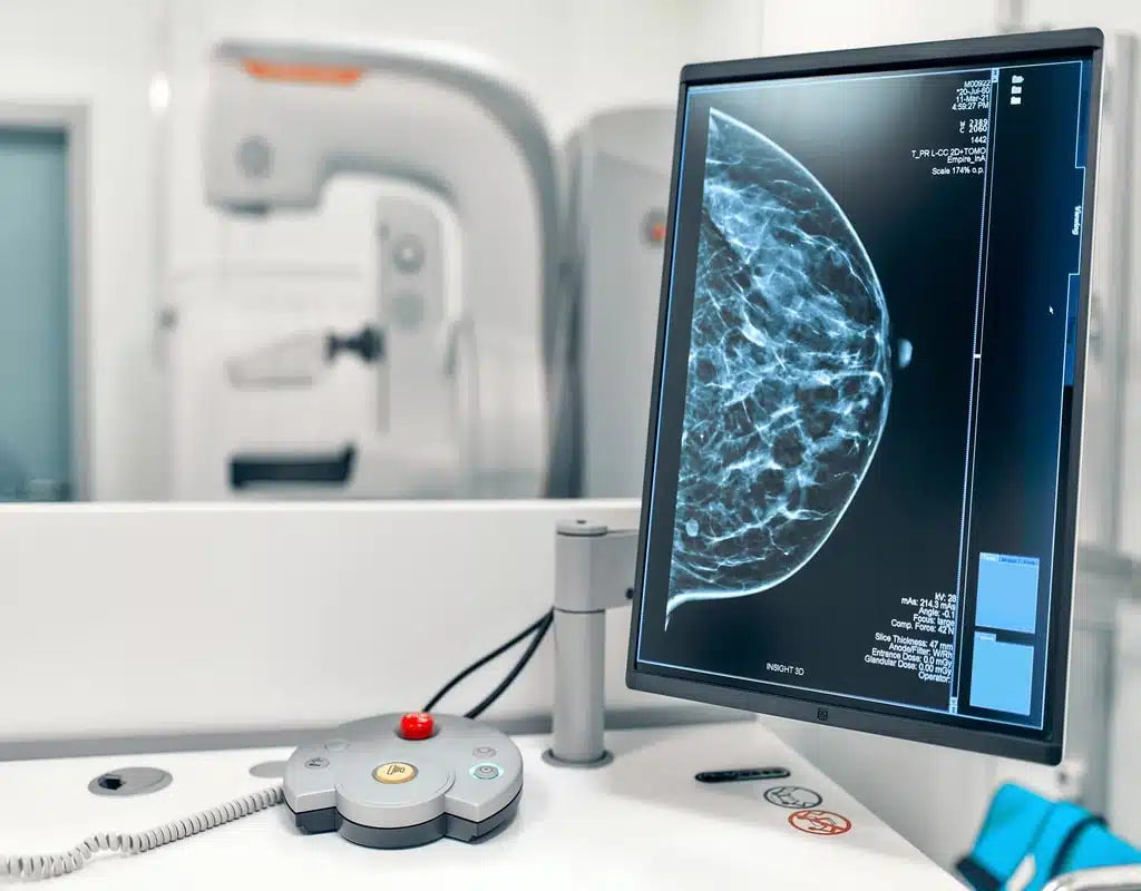Curso de Mamografia